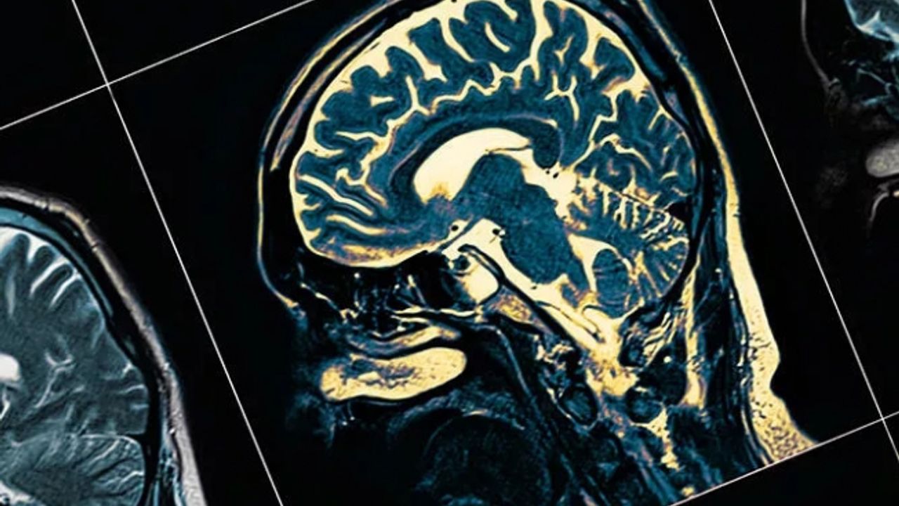 Parkinson'un erken teşhisinde yeni umut kan testi! Bu belirtiler varsa dikkat