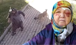 Sokak köpeklerinin saldırdığı yaşlı kadın yaralandı