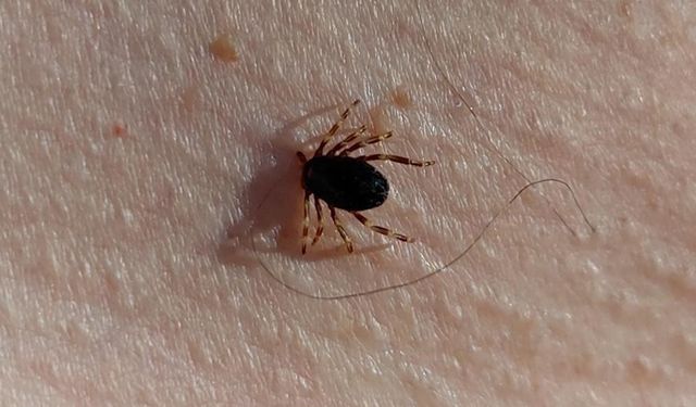 Havalar ısındı, kene kabusu başladı